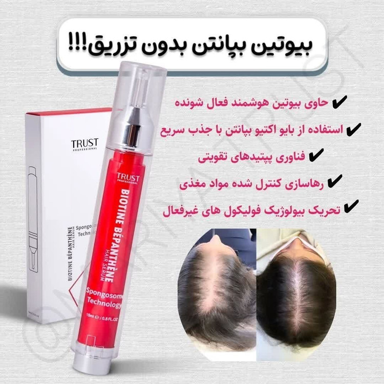 سرم بیوتین بپانتن تراست