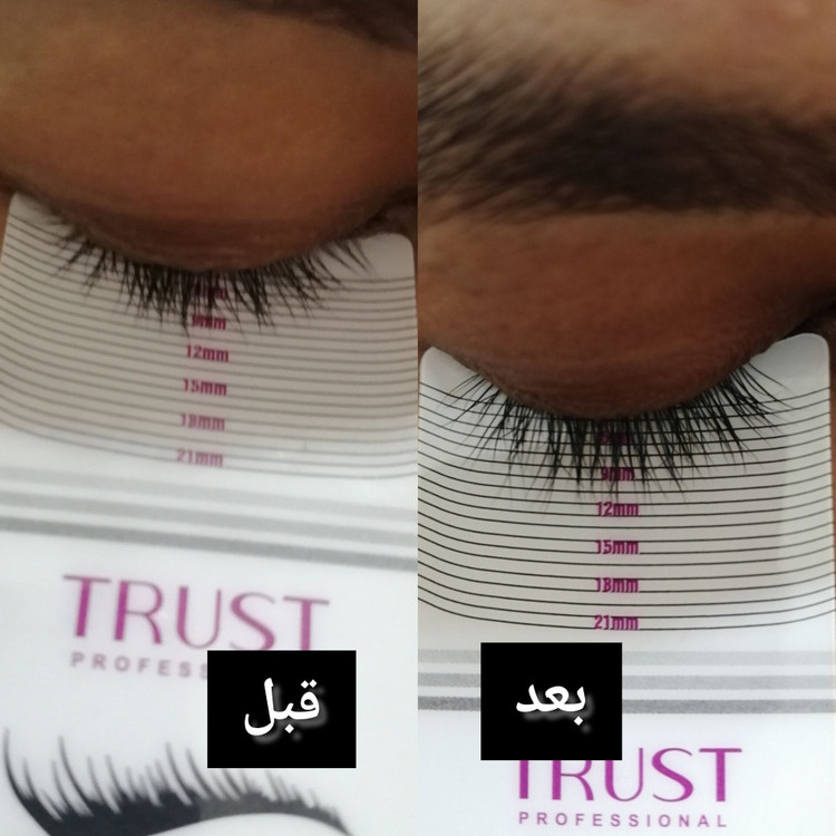 تصویر 5 سرم تقویت مژه تراست