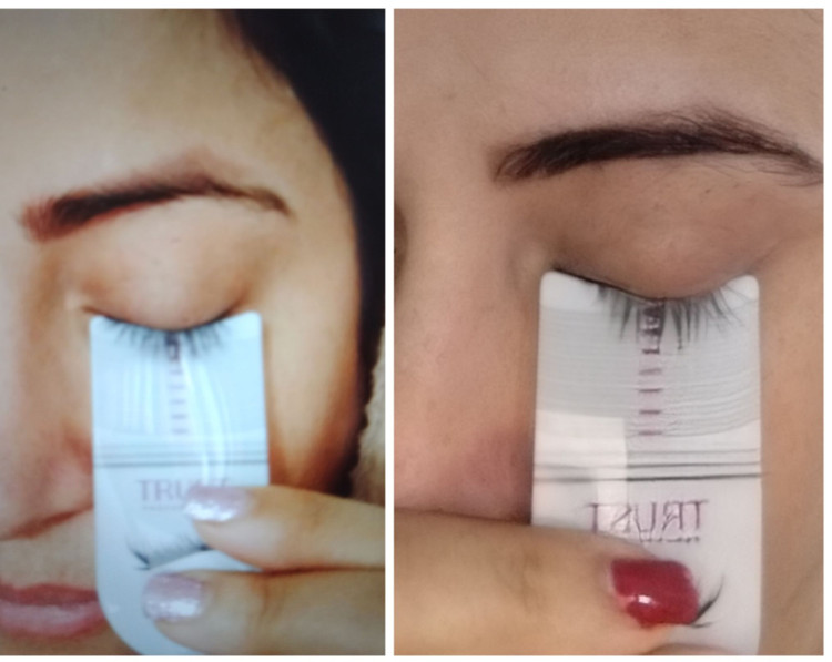 تصویر 6 سرم تقویت مژه تراست