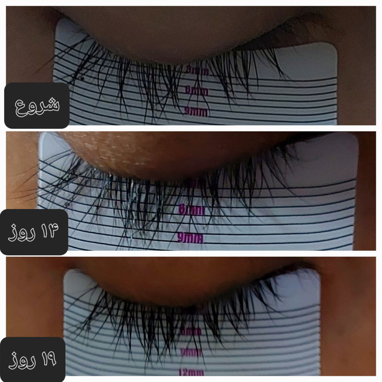 تصویر 7 سرم تقویت مژه تراست